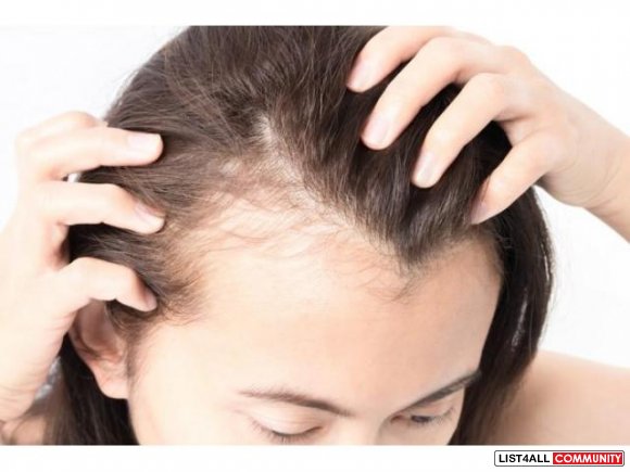 get perfect treatment solution for androgenetic alopecia androgenetic alopecia