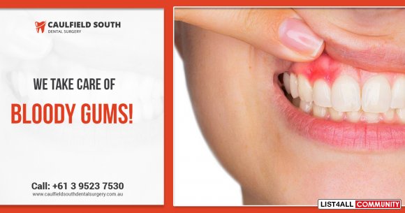 Ensure Healthy Gums with Gum Disease Treatment in Melbourne