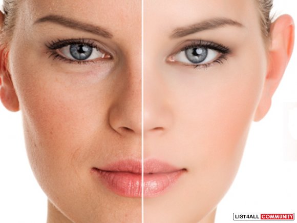 What You Didn’t Know Botox Could Do!