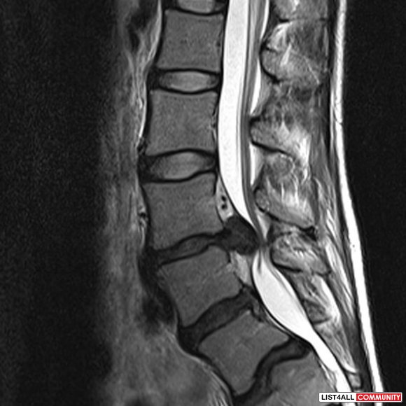 Do You Need a Back and Spine Specialist for Your Loved One?